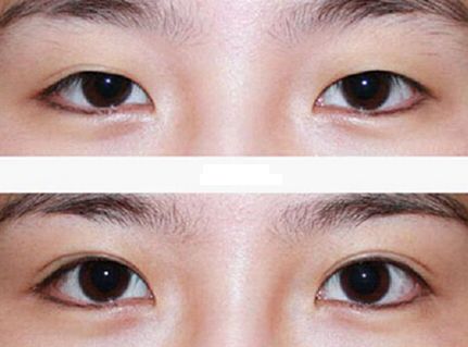 廣州整容鼻子技術排名前列的醫(yī)院有哪些？