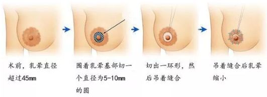 在哈爾濱做除皺哪家醫(yī)院好？選擇專業(yè)除皺醫(yī)生，享受高質(zhì)量護理服務(wù)