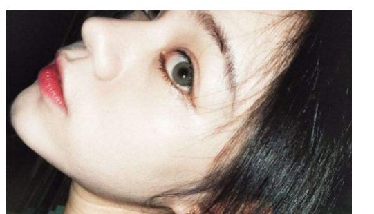 找一家靠譜的汕頭去除疤痕醫(yī)院？看這里！