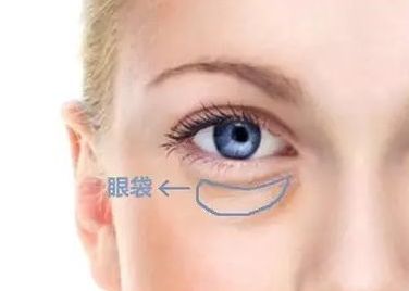 蘇州哪家醫(yī)院治療黃褐斑效果好？