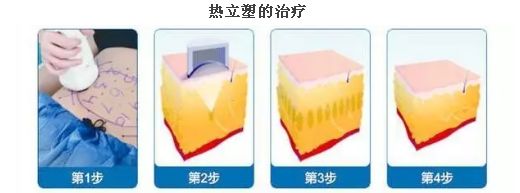 上海臉部祛斑哪家醫(yī)院好？揭秘上海市最受歡迎臉部祛斑醫(yī)院排行榜
