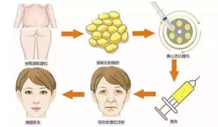 長沙鼻修復(fù)醫(yī)生推薦！多位專家實(shí)力PK，功力高出你的期待！最適合急需求的技術(shù)實(shí)力誰更強(qiáng)？