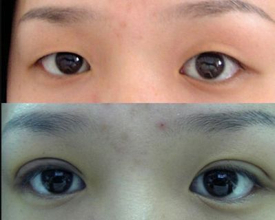 唐山哪家鼻子整形醫(yī)院好？權(quán)威專家為您解答
