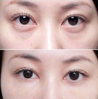 杭州厚唇變薄醫(yī)院哪家好？