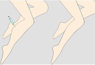 重慶哪些醫(yī)生擅長(zhǎng)磨骨手術(shù)？磨骨手術(shù)費(fèi)用如何？2023年磨骨價(jià)格詳情揭示！