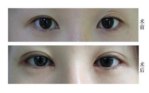 桂林有哪些去痘療效好的醫(yī)院值得推薦？