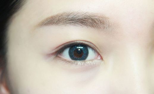無錫頸脖紋線雕整形醫(yī)院推薦指南：提升魅力，告別頸紋困擾