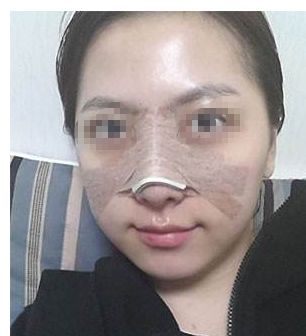告別私處暗沉！盡顯白皙嬌嫩，激光漂紅來一次就有效果嗎？巧妙俘獲男人的心！