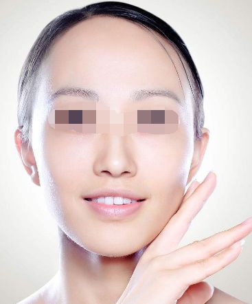 開(kāi)眼角能讓眼睛看起來(lái)更大？現(xiàn)實(shí)經(jīng)驗(yàn)告訴你答案！