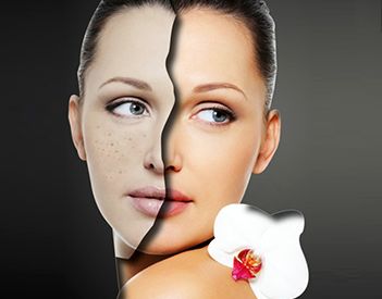 北京雙眼皮修復(fù)的效果如何？什么狀況需要做雙眼皮修復(fù)？
