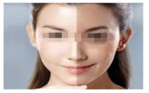 吃海鮮對(duì)于使用瘦腿針的人來(lái)說(shuō)是否適合？