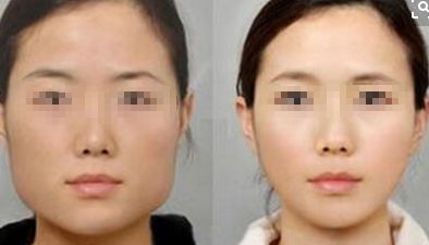 整形美容：底線與標準