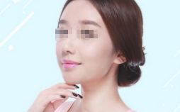 雙眼皮修復(fù)，選對時(shí)機(jī)，展現(xiàn)美麗眼眸