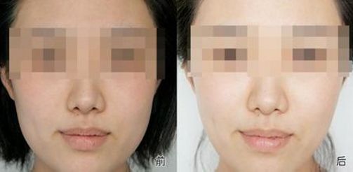 有效改善黑眼圈的飲食和作息調(diào)整方法！