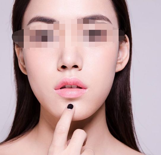 透明質(zhì)酸隆鼻注射后：如何避免過(guò)敏癥狀的突發(fā)