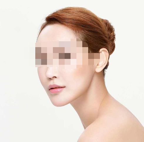 處女膜修復(fù)手術(shù)成功率及手術(shù)過(guò)程詳解