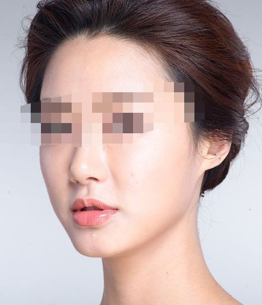 搶拍夏日纖體良方，四大瘦身法解析深度對(duì)比！