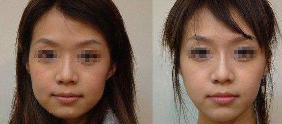 長期外眼角傷害視力？這樣保護(hù)眼睛更有效！