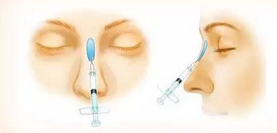 美白祛斑的方法有哪些？4種醫(yī)美美肌方案推薦
