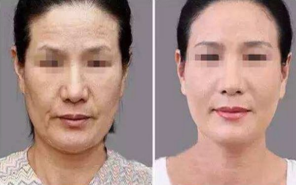 如何讓幼態(tài)臉變得緊致有型？塑造迷人圓潤臉型攻略揭秘！