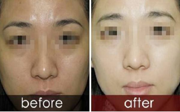 曬黑后如何迅速變白？曬黑美白需要持續(xù)護(hù)理多久結(jié)果可見(jiàn)？了解曬后護(hù)膚科普！