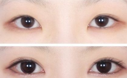 南京中醫(yī)院優(yōu)秀雙眼皮專家推薦，值得信賴！完善的醫(yī)生介紹、項目介紹及價格表供參考