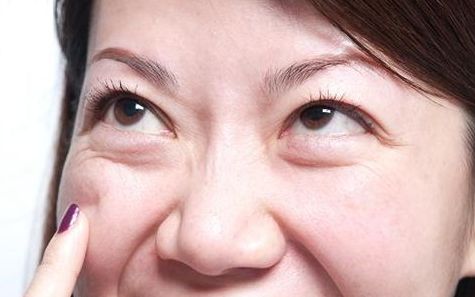 上海九院去眼袋專家推薦，最全擅長項目及費用一覽