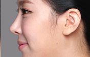 東莞第五人民醫(yī)院美容科綜合評(píng)價(jià)及專家推薦！