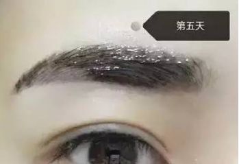 南昌美伊爾劉立軍醫(yī)生膨體隆鼻整形費用？手術效果如何？帶您看醫(yī)生案例