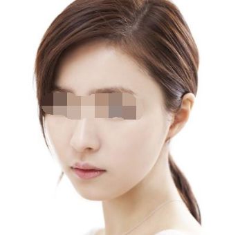 株洲有哪些優(yōu)秀整形醫(yī)院值得關(guān)注？