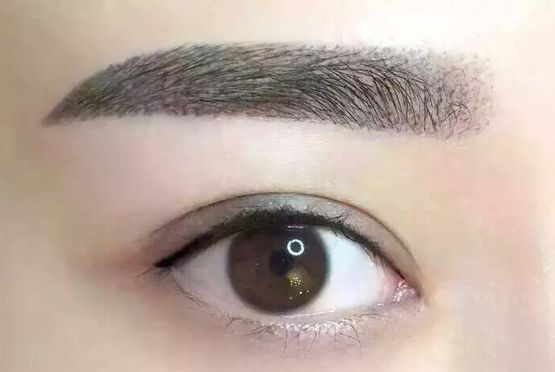 喬軍醫(yī)生眼部整形手術(shù)能力如何？詳解醫(yī)生經(jīng)歷與成功案例