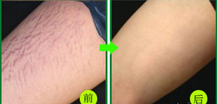 杭州整容醫(yī)院推薦，這幾家非常值得選擇