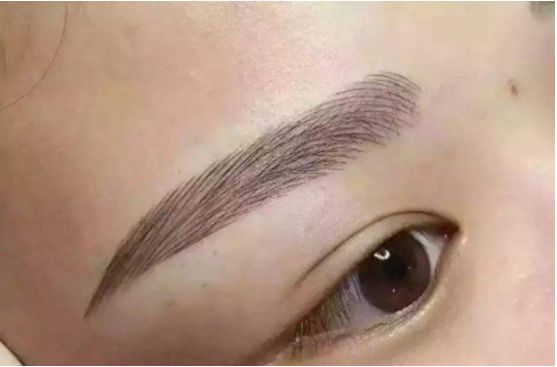 武漢葉子榮做拉皮的療效如何？專家醫(yī)生分享經(jīng)典案例