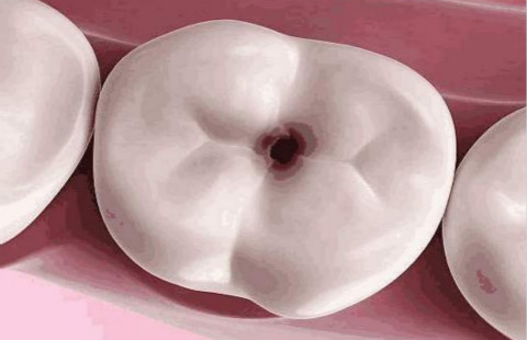 滄州有哪些醫(yī)院可以信賴進(jìn)行開(kāi)眼角手術(shù)？如何選擇更適合自己的醫(yī)院？