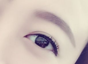 劉春軍豐胸手術(shù)后效果如何？費(fèi)用怎么樣？醫(yī)生概況+隆胸真實(shí)案例圖為參考