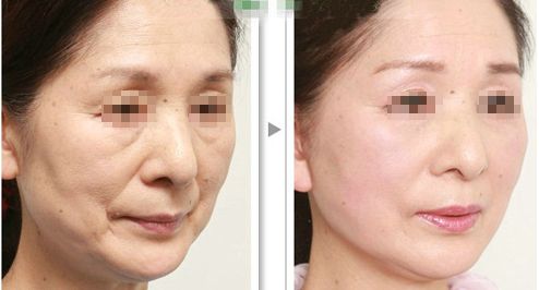 上海哪家磨骨醫(yī)院靠譜？華美、美聯(lián)臣、薇琳資歷雄厚值得信賴
