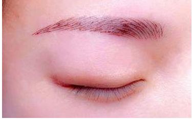 深圳醫(yī)生劉冰的鼻子整形效果如何？專業(yè)實(shí)力及成功案例發(fā)布