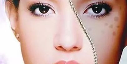 上海眼部修復專家推薦，治療眼部問題可信賴！
