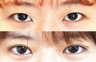 蚌埠醫(yī)學(xué)院第一附屬醫(yī)院眼科權(quán)威專家推薦！