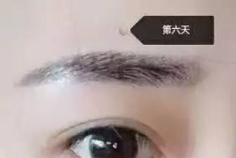 成都江濤雙眼皮術(shù)醫(yī)生坐診地點及案例分析