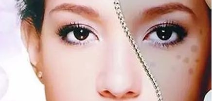 周一雄如何預約雙眼皮手術？案例分享與價格真實評估