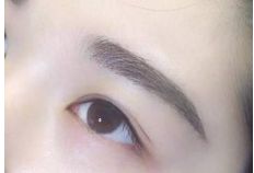 重慶銅雀臺(tái)地區(qū)雙眼皮手術(shù)頂級(jí)醫(yī)生推薦！詳細(xì)收費(fèi)一覽表