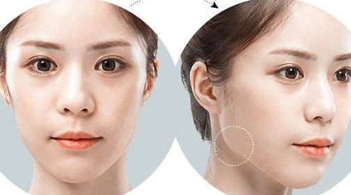 南京乳房美容醫(yī)院推薦，頂級醫(yī)療機構(gòu)推薦閱讀