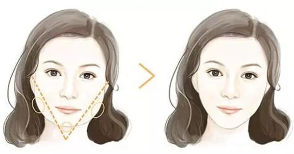 深圳吸脂修復(fù)醫(yī)院哪家專業(yè)？這八強(qiáng)機(jī)構(gòu)到底有何絕技？