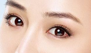 成都米蘭柏羽雙眼皮曝光！醫(yī)生做雙眼皮風(fēng)格如何？對(duì)比照片供參考