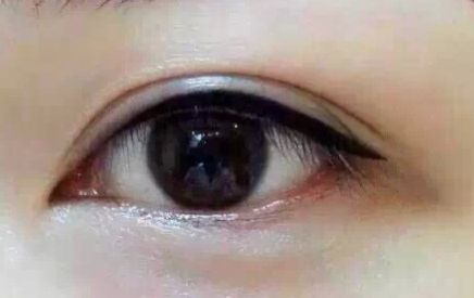 上海9院專家分享軟骨隆鼻案例，LiQingfeng的技術(shù)備受推崇！