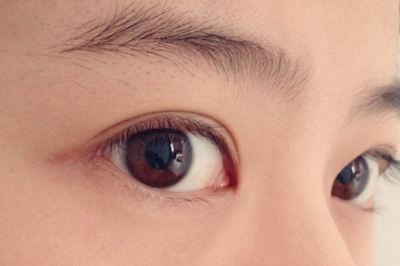 如何選擇適合自己的祛斑醫(yī)院？哪些醫(yī)院是值得嘗試的？