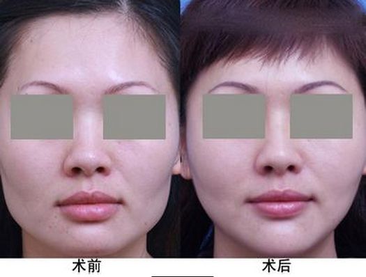 中國最受歡迎的十大整形醫(yī)院評選結果公布