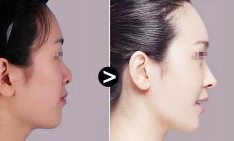 昆明專(zhuān)業(yè)整形治療醫(yī)院揭秘！口碑TOP10震撼推薦，守護(hù)您的隱私需求！