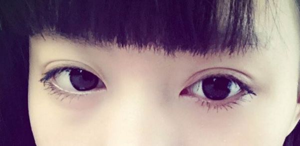 靠前重慶眼部整形醫(yī)院榜單出爐，時(shí)光整形受認(rèn)可